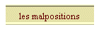 les malpositions