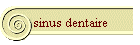 sinus dentaire